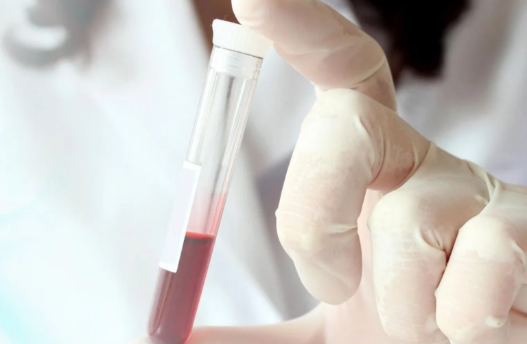 Rastet me kancer gjaku, Ivanaj: Çdo vit diagnostikohen 55 raste të reja vetëm në Shqipëri