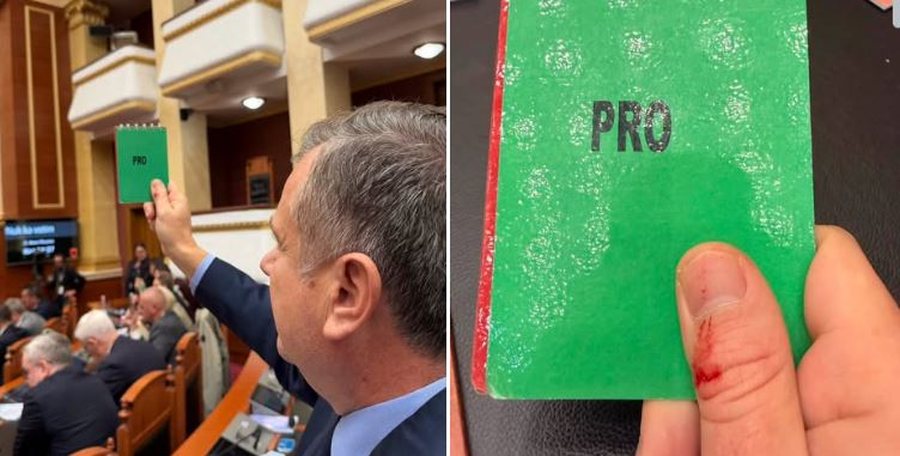 With a bloodied finger, Balla responds to Berisha: 100 thousand lek per head for the masks of violence