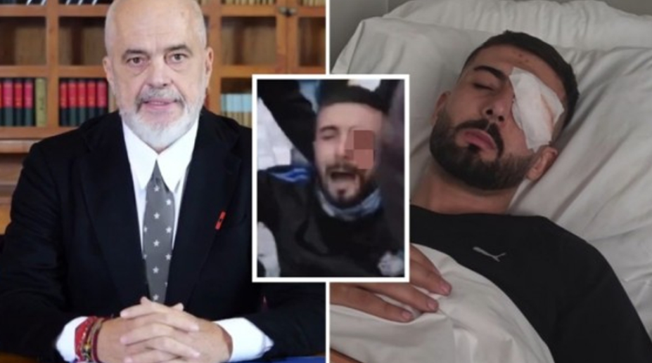 Reagon Kryeministri për rastin e Erjon Vishkullit