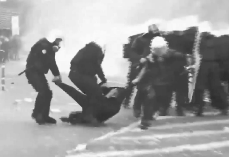 Policët i thyen këmbën në protestë, Ledion Balla tregon ngjarjen. Nëna tregon dëmtimet e rënda